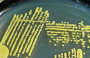 佛山沃特参加ACAS-PT1873食品中金黄色葡萄球菌检测能力验证（第一轮）获“满意”结果